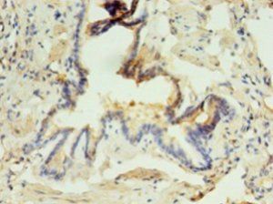 ABHD3 Antibody