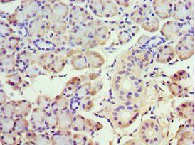 ABHD5 Antibody