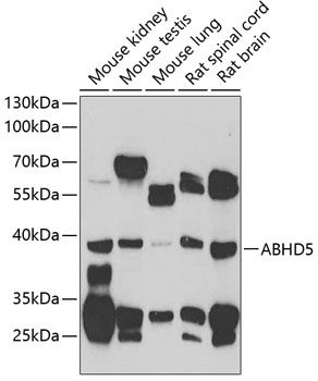 ABHD5 antibody