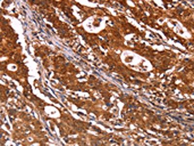 ABI1 Antibody