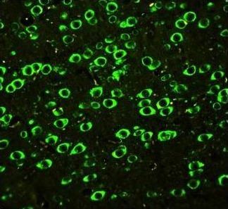 Anti-SSH3BP1/ABI1 Antibody