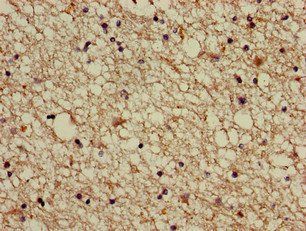 ABI2 Antibody