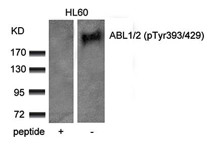 ABL1/2 (phospho-Tyr393/439) Antibody