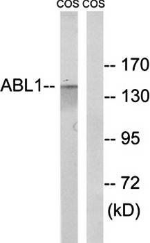 ABL1 antibody