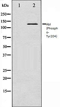 Abl (Phospho-Tyr204) antibody