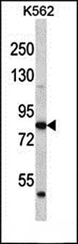 ABTB2 antibody