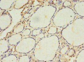 ACAA1 Antibody