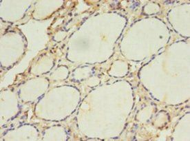 ACAA1 antibody