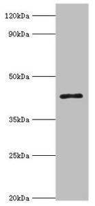 ACAA1 antibody