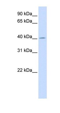 ACAA2 antibody