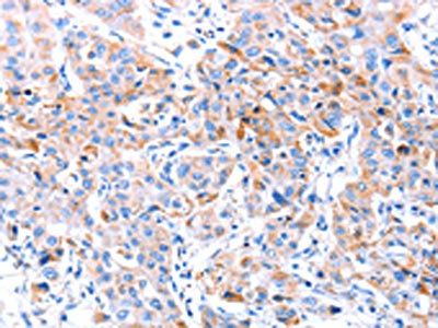 ACAA2 antibody