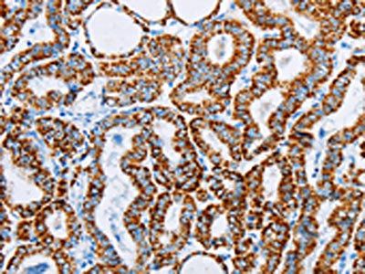 ACAA2 antibody