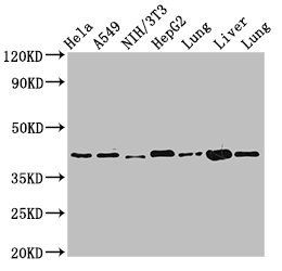 ACAA2 antibody