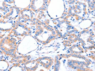 ACAD10 Antibody