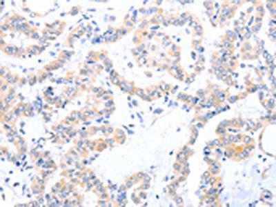 ACAD10 Antibody
