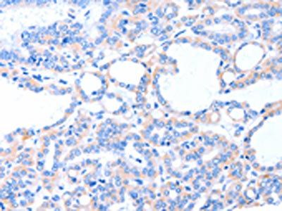 ACAD8 Antibody