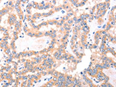ACAD8 Antibody