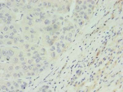 ACADL Antibody
