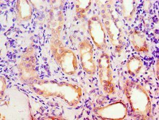 ACADM Antibody