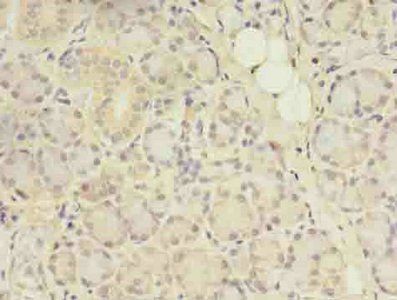 ACAP1 Antibody