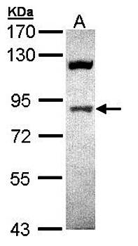 ACAP1 antibody