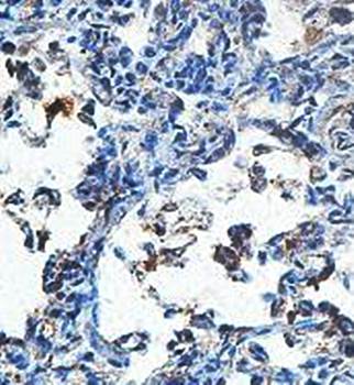 ACAP3 Rabbit Polyclonal Antibody