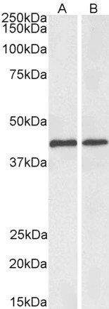 Goat anti-ACAT1 (aa253-266), Biotinylated Antibody