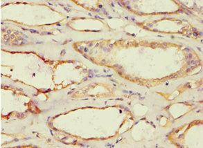 ACAT1 Antibody