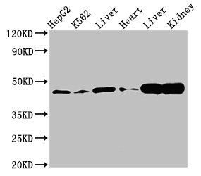 ACAT1 antibody