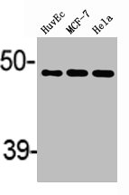 ACAT1 Antibody