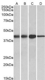 Goat anti-ACAT1 (aa257-269) Antibody