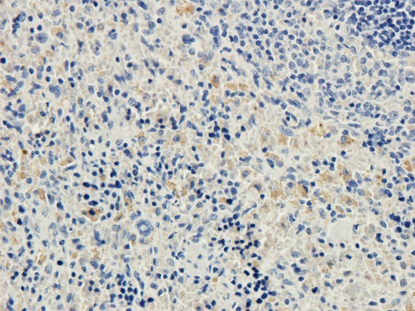 ACAT2 antibody