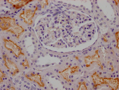 ACE Recombinant Monoclonal Antibody