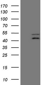 Angiotensin Converting Enzyme 2 Antibody