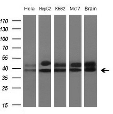 Angiotensin Converting Enzyme 2 Antibody