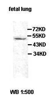 ACER1 Rabbit Polyclonal Antibody