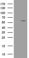 Acetyl CoA synthetase (ACSS2) antibody
