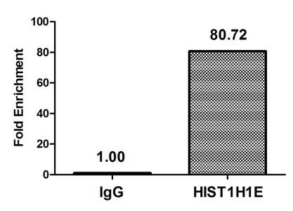 Acetyl-HIST1H1E (K16) antibody