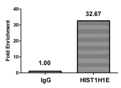 Acetyl-HIST1H1E (K63) antibody