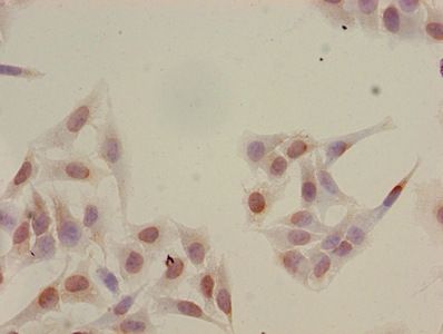 Acetyl-HIST1H2BB (K16) Antibody