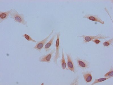 Acetyl-HIST1H2BB (K5) Antibody