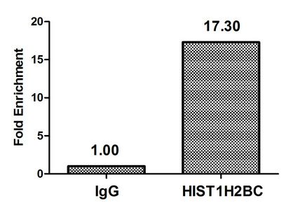 Acetyl-HIST1H2BC (K85) antibody