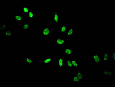 Acetyl-HIST1H3A (K14) antibody