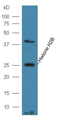 Acetyl-Histone H2B (K20) antibody