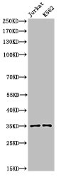 Acetyl-APEX1 (K7) antibody