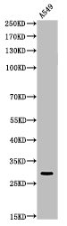 Acetyl-ATF5 (K29) antibody