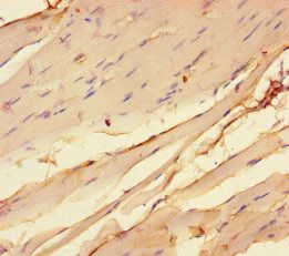 CHRNA1 Antibody