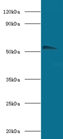 Acetylcholine R subunit alpha antibody (Biotin)