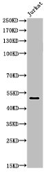 Acetyl-FOXA1 (K264/253/211) antibody