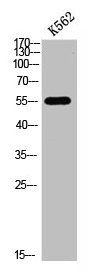 Acetyl-FOXO4 (Lys189) antibody
